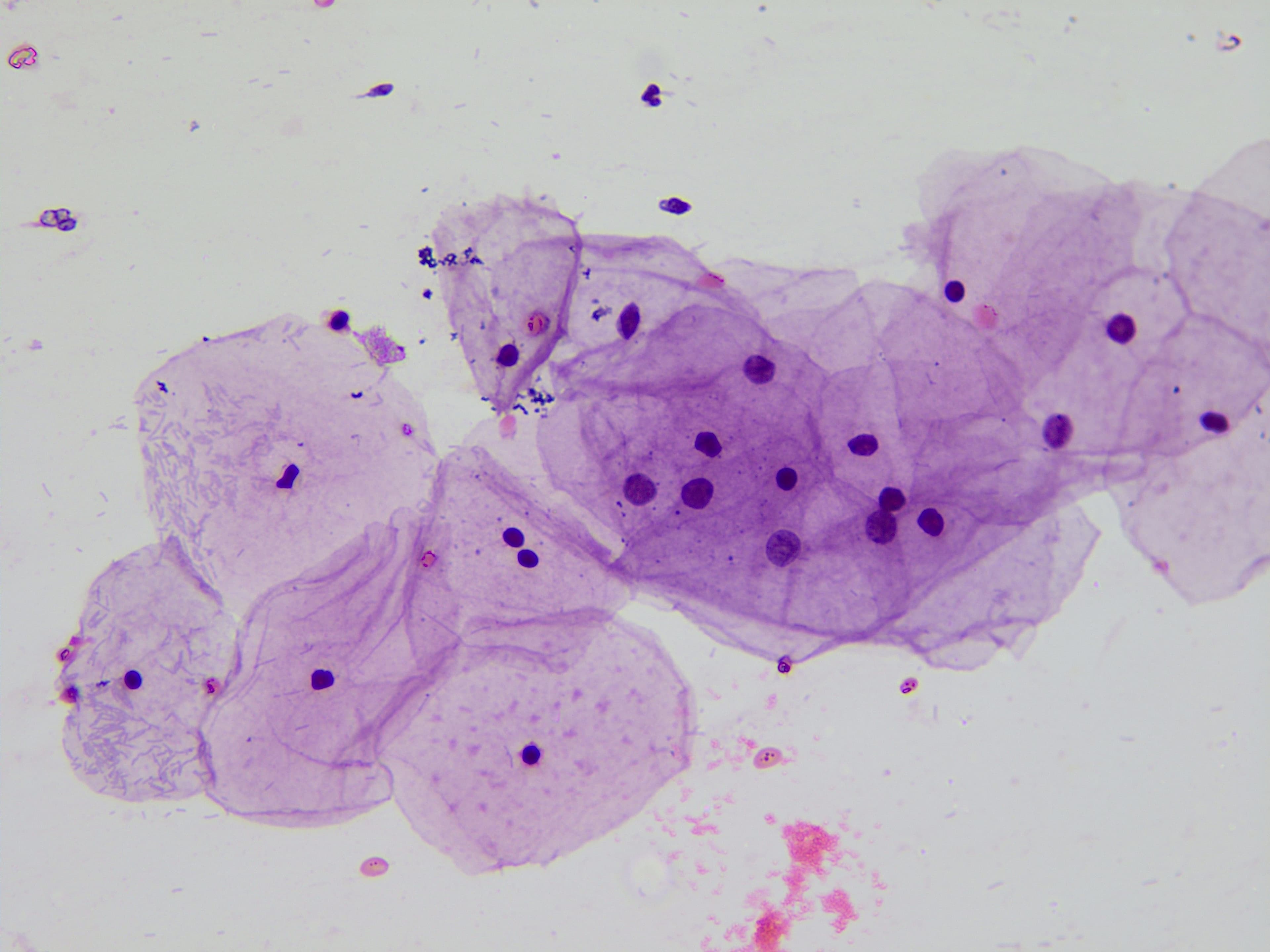 NILM microscopy sample