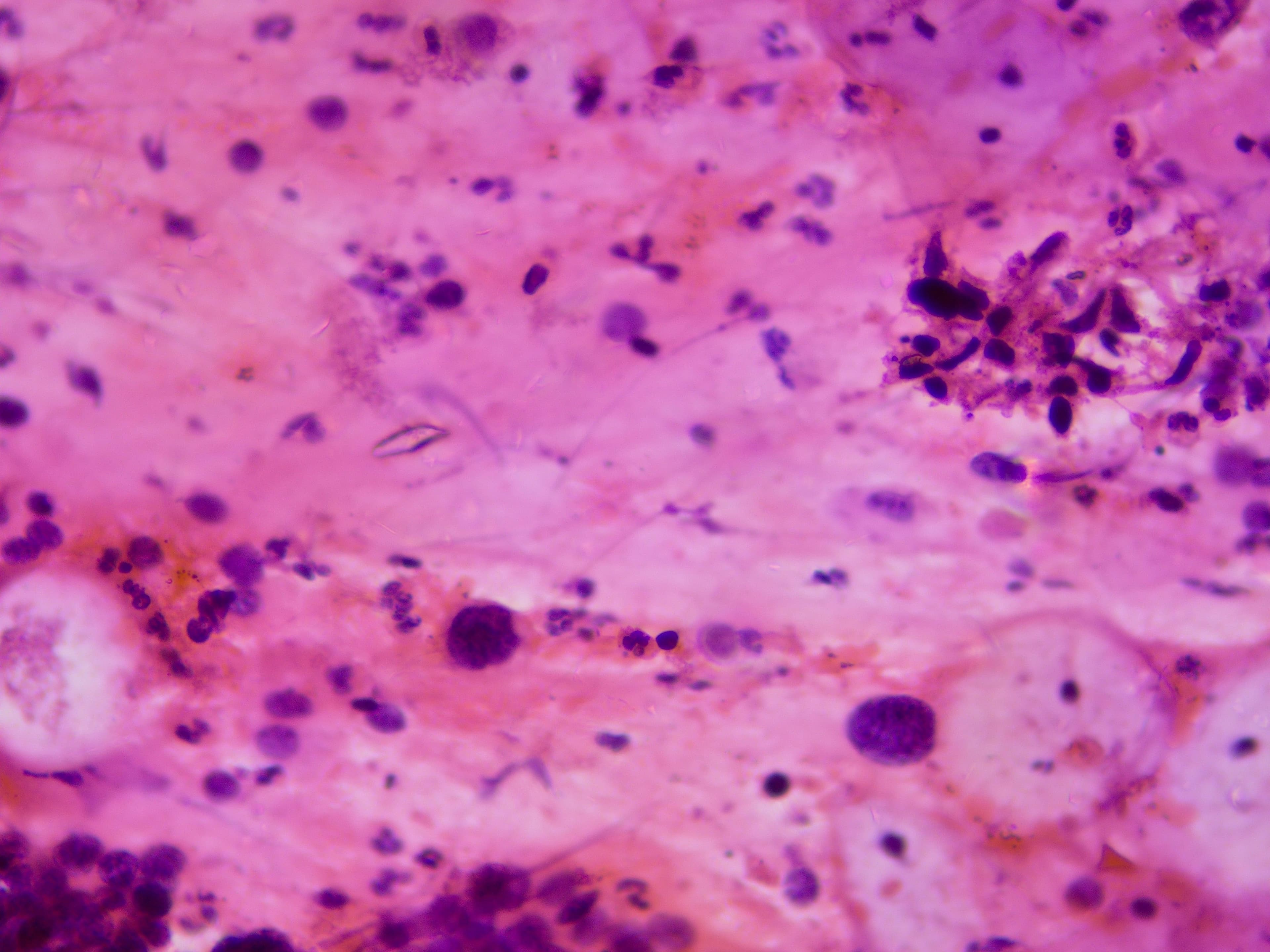 SCC microscopy sample